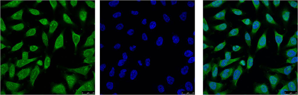 product-image-AAA30801_IHC5.png