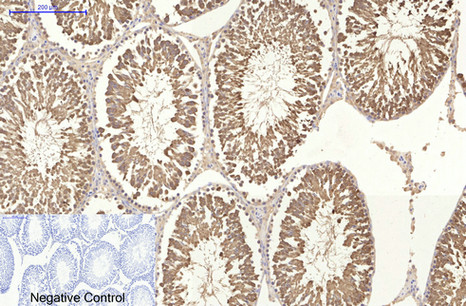 product-image-AAA30801_IHC7.png