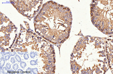 product-image-AAA30802_IHC5.png