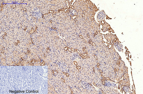 product-image-AAA30802_IHC6.png
