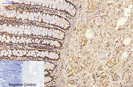 product-image-AAA30806_IHC4.png