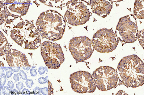 product-image-AAA30806_IHC5.png