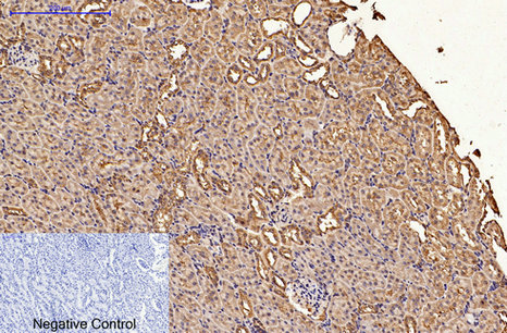 product-image-AAA30806_IHC6.png