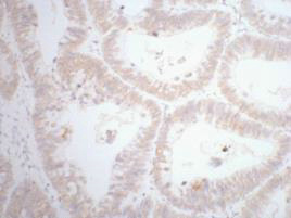 product-image-AAA30806_IHC7.png