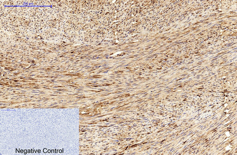 product-image-AAA30824_IHC3.png