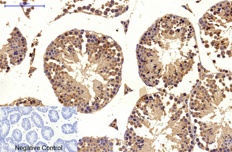 product-image-AAA30824_IHC4.png