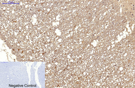 product-image-AAA30824_IHC5.png