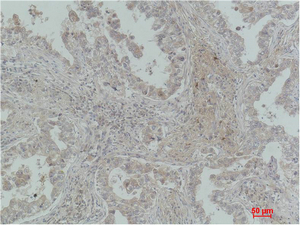 product-image-AAA30824_IHC6.png