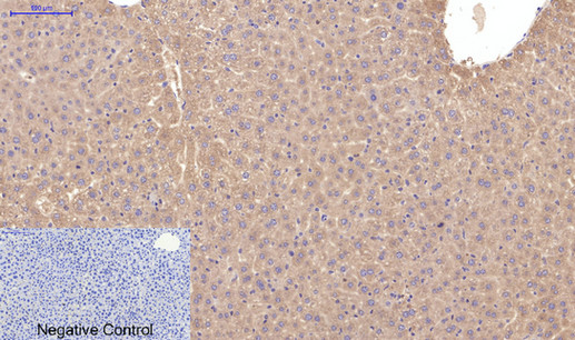 product-image-AAA30825_IHC5.png