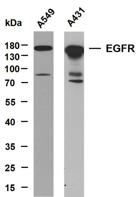 product-image-AAA30858_SDS_PAGE.png