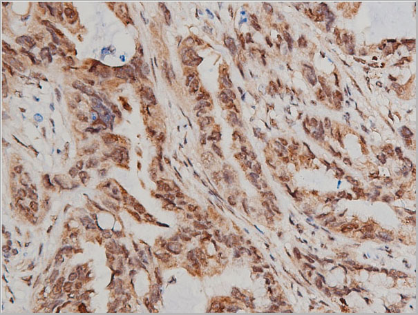 product-image-AAA30920_IHC2.jpg