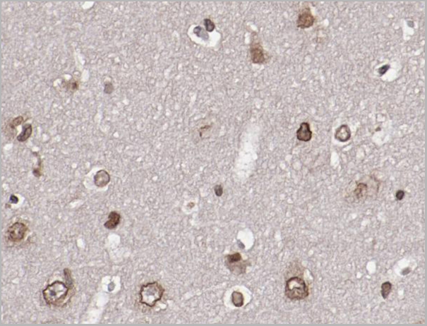 product-image-AAA30920_IHC4.jpg
