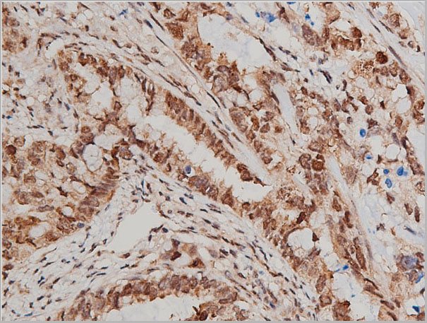 product-image-AAA30920_IHC7.jpg