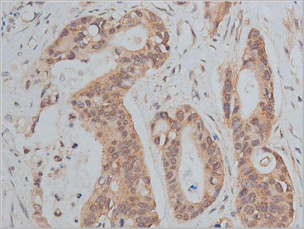 product-image-AAA30922_IHC4.jpg