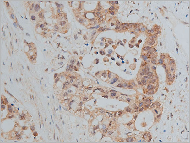 product-image-AAA30922_IHC5.jpg