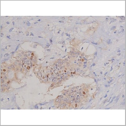 product-image-AAA30924_IHC3.jpg