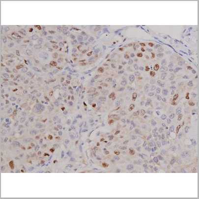 product-image-AAA30924_IHC4.jpg