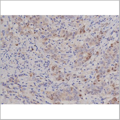 product-image-AAA30924_IHC5.jpg