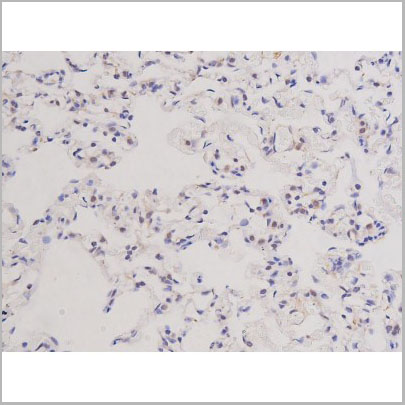 product-image-AAA30924_IHC6.jpg