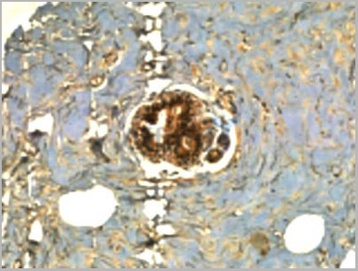 product-image-AAA30924_IHC7.jpg