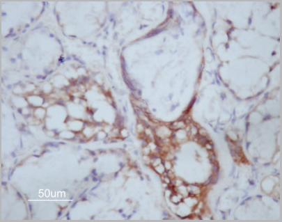 product-image-AAA30926_IHC2.jpg