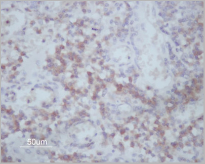 product-image-AAA30926_IHC3.jpg