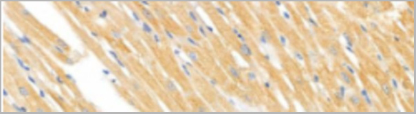product-image-AAA30926_IHC4.jpg