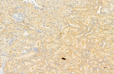 product-image-AAA30928_IHC6.jpg