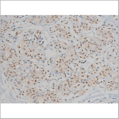 product-image-AAA30930_IHC2.jpg