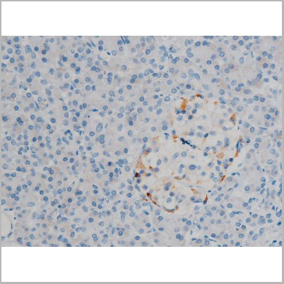 product-image-AAA30930_IHC3.jpg