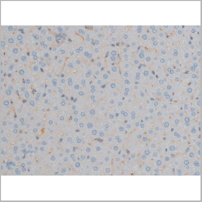 product-image-AAA30930_IHC4.jpg