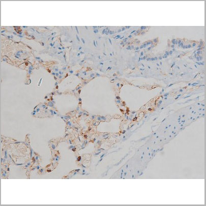 product-image-AAA30930_IHC6.jpg