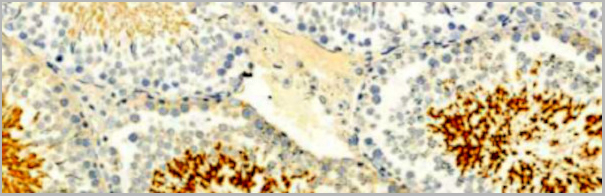product-image-AAA30932_IHC2.jpg