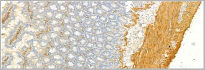 product-image-AAA30933_IHC13.jpg