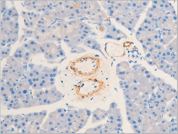 product-image-AAA30933_IHC2.jpg