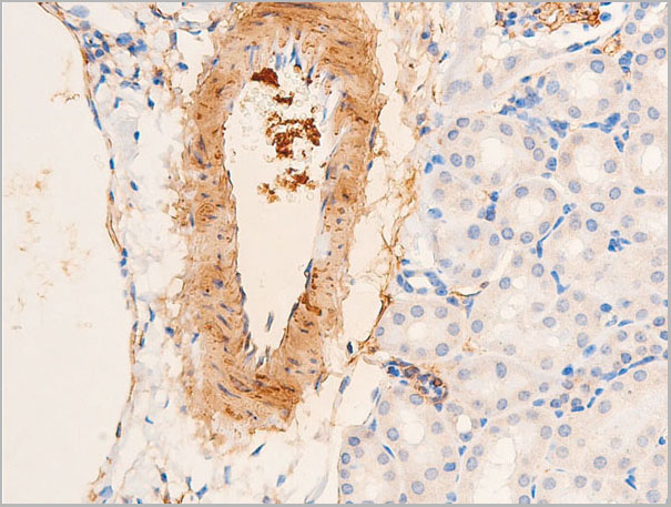 product-image-AAA30933_IHC3.jpg