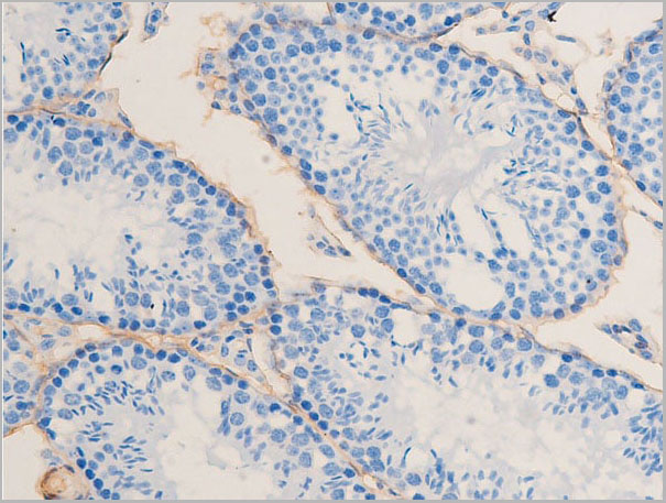 product-image-AAA30933_IHC4.jpg
