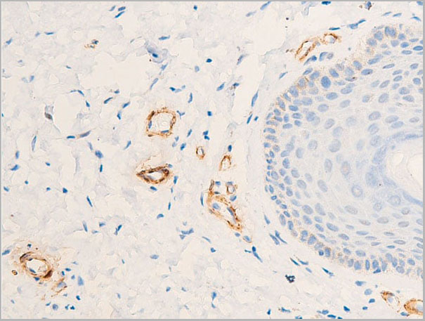 product-image-AAA30933_IHC5.jpg