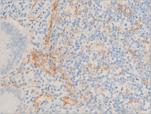 product-image-AAA30933_IHC6.jpg