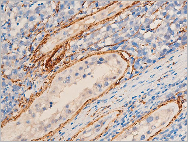 product-image-AAA30933_IHC7.jpg