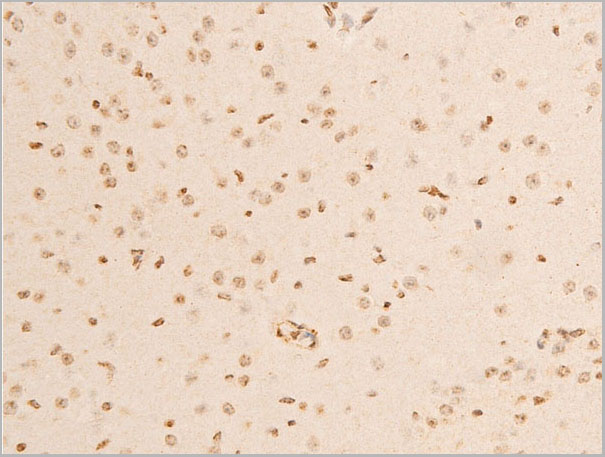 product-image-AAA30934_IHC5.jpg