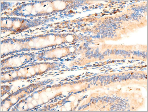 product-image-AAA30934_IHC9.jpg