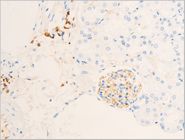 product-image-AAA30935_IHC2.jpg