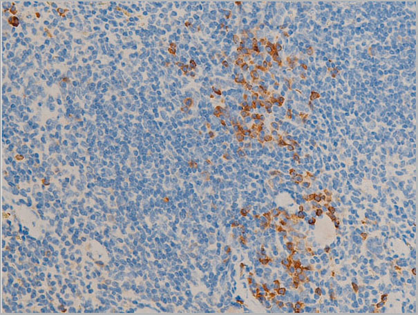 product-image-AAA30935_IHC3.jpg