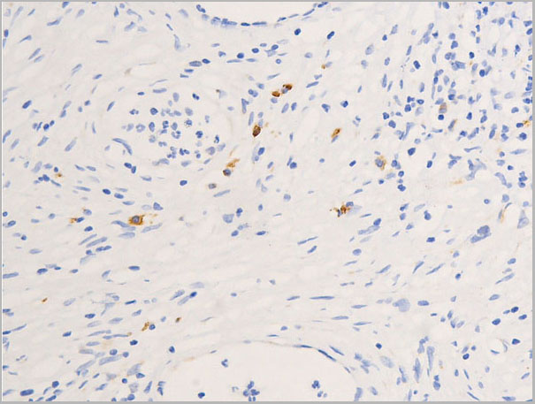 product-image-AAA30935_IHC4.jpg
