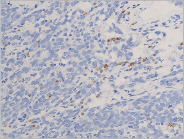 product-image-AAA30935_IHC6.jpg