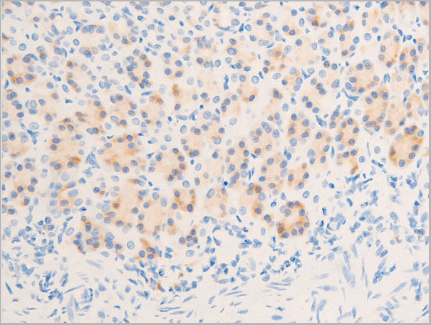 product-image-AAA30935_IHC7.jpg