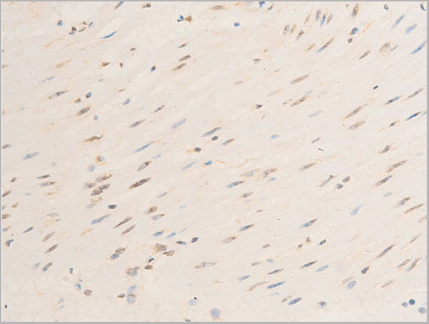 product-image-AAA30936_IHC4.jpg
