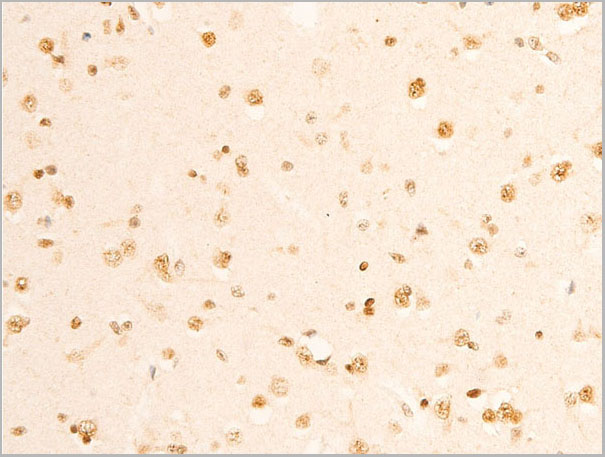 product-image-AAA30936_IHC5.jpg