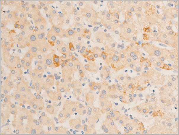 product-image-AAA30936_IHC6.jpg